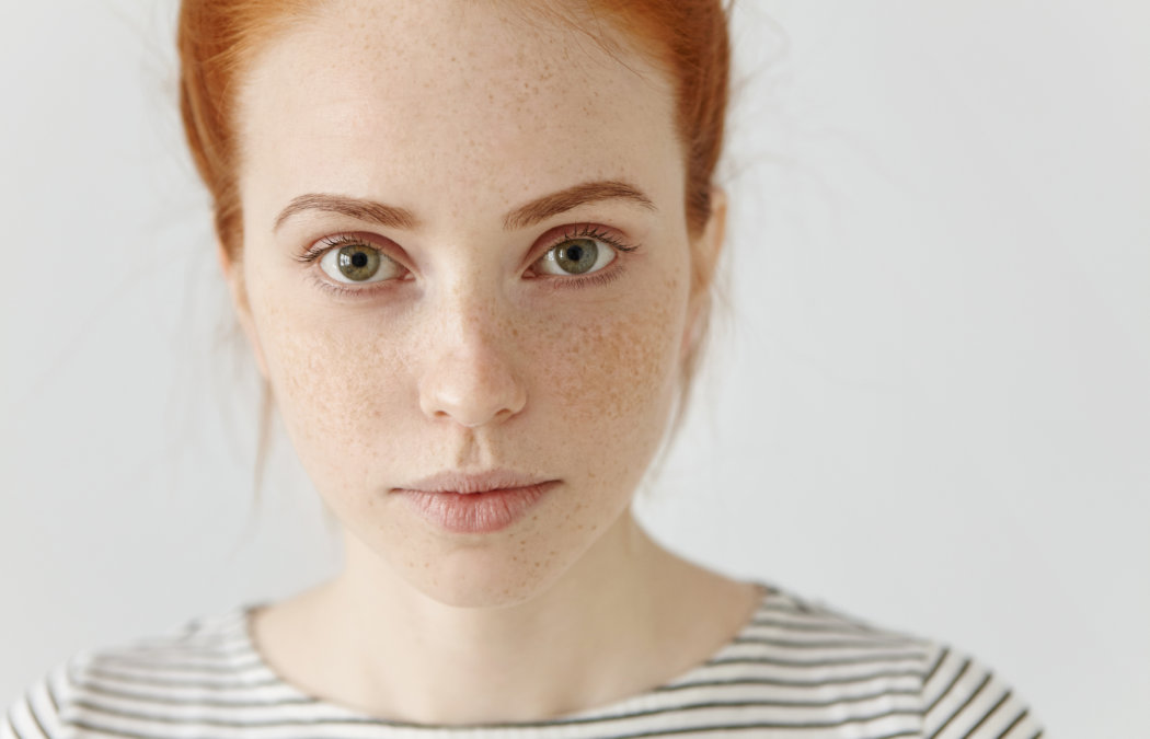 A woman with fair skin, red hair, and freckles looks directly at the camera. She is wearing a white and black striped shirt and is set against a plain white background.